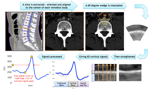 Spinal Measures (cortical bone)